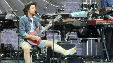James Bay با پای شکسته در کنسرت Bon Jovi روی صحنه رفت