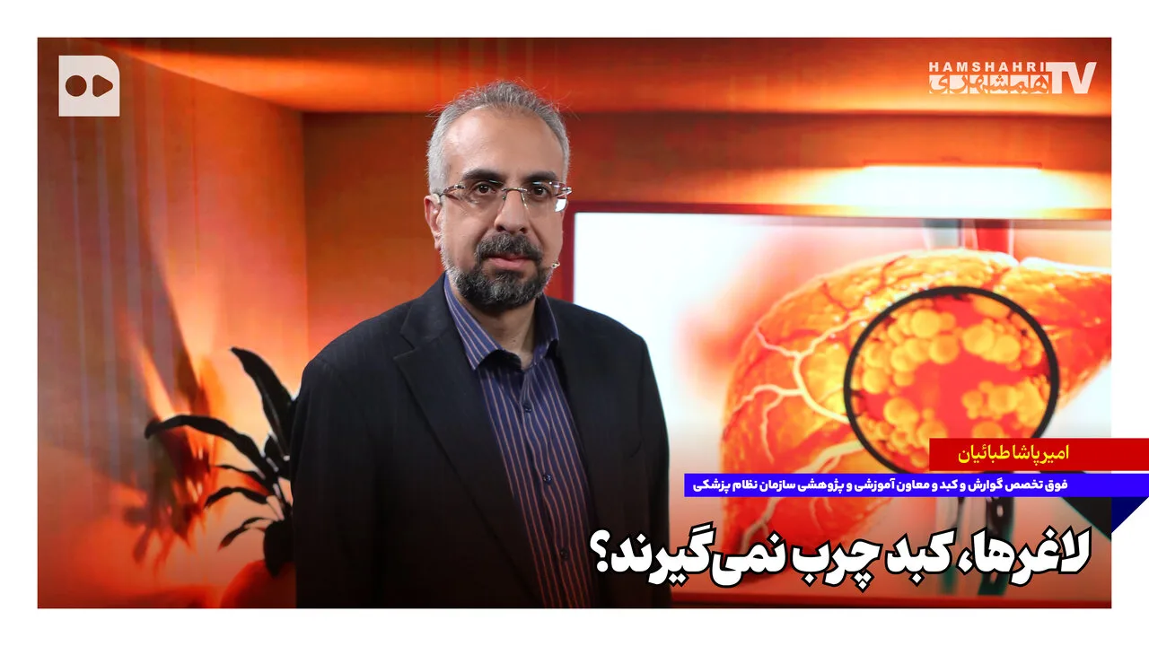 امیرپاشا طبائیان: افراد لاغر نیز ممکن است به کبد چرب مبتلا شوند