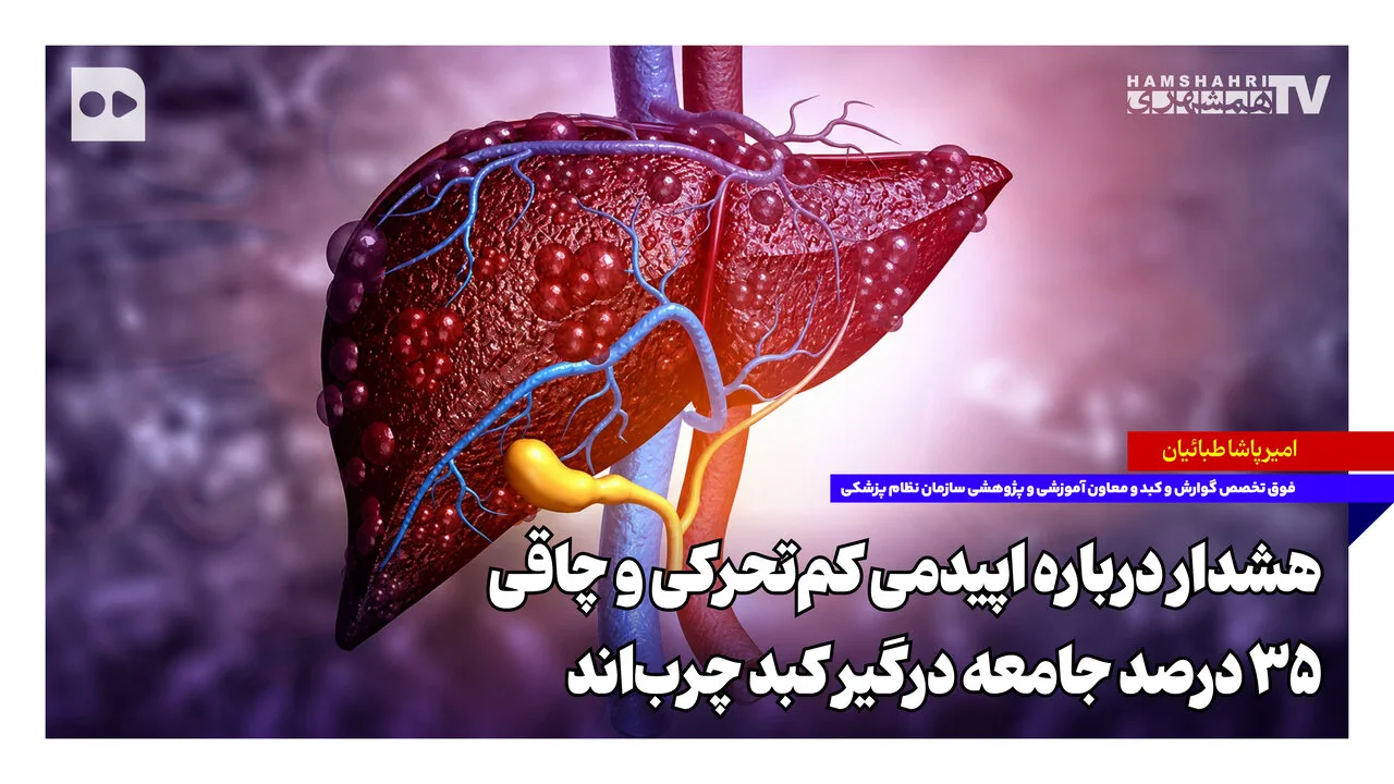 امیرپاشا طبائیان: ۳۵ درصد جامعه به کبد چرب مبتلا شده‌اند