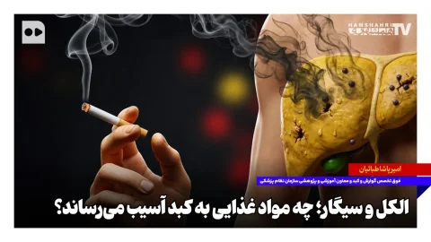 امیرپاشا طبائیان: کنترل چاقی شکمی بهترین راهکار برای پیشگیری از کبد چرب