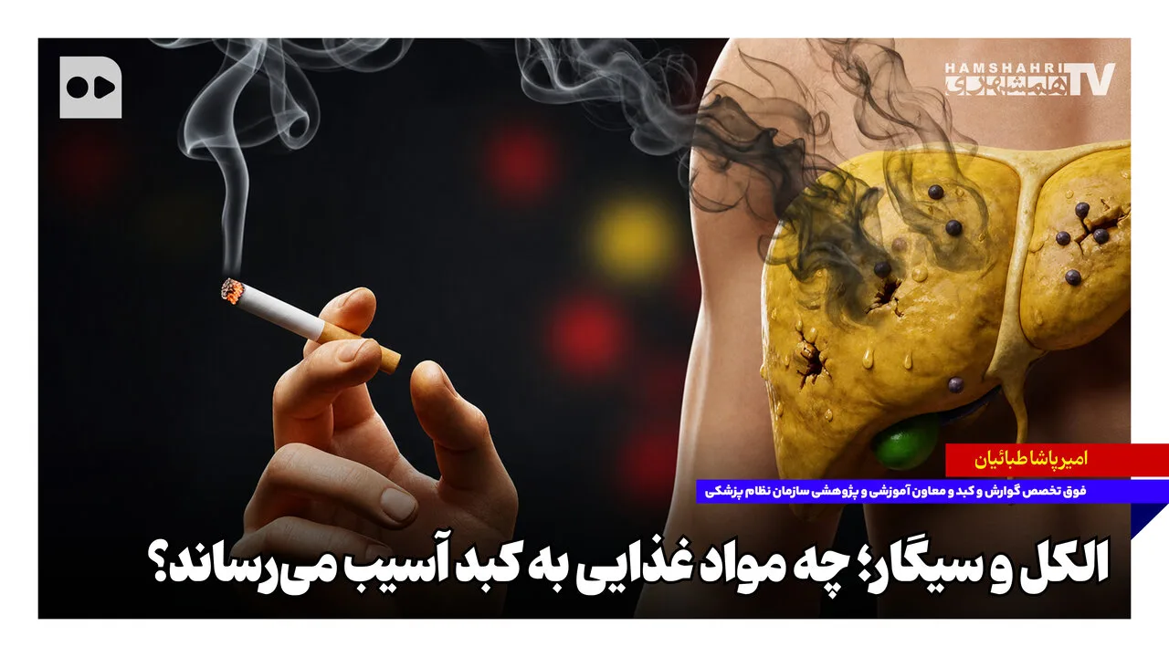 امیرپاشا طبائیان: کنترل چاقی شکمی بهترین راهکار برای پیشگیری از کبد چرب