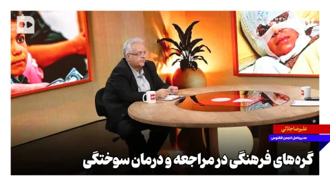علیرضا جلالی: گره‌های فرهنگی در درمان سوختگی بیماران