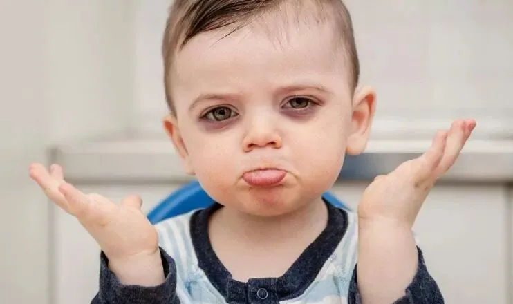 غلامرضا باهوش: تیرگی زیر چشم کودکان نشانه ایتوپی است نه کمخونی