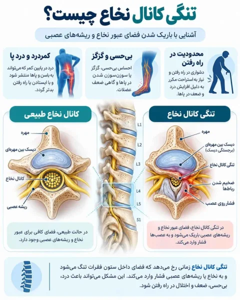 علائم تومور مغزی و نشانه‌های هشداردهنده آن