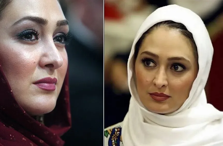 تغییر چهره الهام حمیدی توجهات را جلب کرد