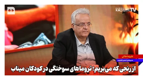 رنج سوختگی کودکان میناب و نیاز به حمایت‌های روانی